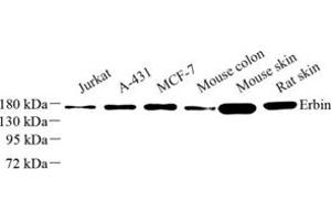 Western blot analysis of Erbin (ABIN7073858) at dilution of 1: 500 (ERBB2IP Antikörper)