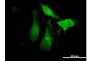 Immunofluorescence of purified MaxPab antibody to CFHR1 on HeLa cell. (CFHR1 Antikörper  (AA 1-330))