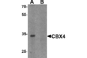 Western blot analysis of CBX4 in human brain tissue lysate with CBX4 antibody at 1 µg/mL in (A) the absence and (B) the presence of blocking peptide. (CBX4 Antikörper  (N-Term))