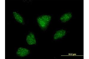 Immunofluorescence of purified MaxPab antibody to R3HDM2 on HeLa cell. (R3HDM2 Antikörper  (AA 1-637))