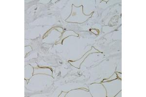 Immunohistochemistry of paraffin-embedded human breast adipocytes using GPD1 Antibody. (GPD1 Antikörper)