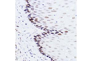 Immunohistochemistry of paraffin-embedded human esophageal using p73 Rabbit mAb (ABIN1678945, ABIN1678944, ABIN7101487 and ABIN7101488) at dilution of 1:100 (40x lens). (Tumor Protein p73 Antikörper)