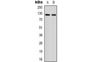 Western blot analysis of XPO1 (AcK568) expression in HepG2 UV-treated (A), mouse brain (B) whole cell lysates. (XPO1 Antikörper  (acLys568))
