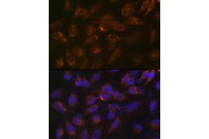 Immunofluorescence analysis of U-251 MG cells using IGFBP7 Rabbit mAb (ABIN7267910) at dilution of 1:100 (40x lens). (IGFBP7 Antikörper)