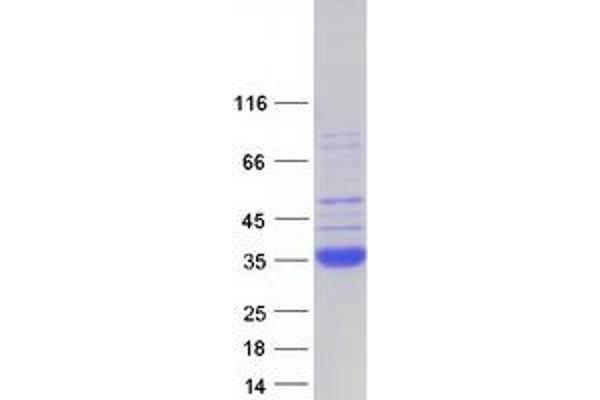 SFTPA2 Protein (Myc-DYKDDDDK Tag)