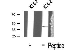 Western blot analysis of Interleukin 12B expression in K562 cells (IL12B Antikörper  (C-Term))