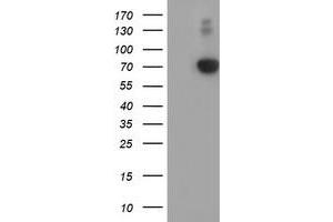 Western Blotting (WB) image for anti-alpha-Fetoprotein (AFP) antibody (ABIN1496491) (alpha Fetoprotein Antikörper)