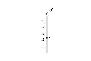 Anti-Eras Antibody (C-term)at 1:2000 dilution + mouse kidney lysates Lysates/proteins at 20 μg per lane. (ERAS Antikörper  (C-Term))