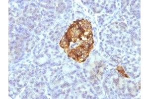 Formalin-fixed, paraffin-embedded pancreas stained with Chromogranin A antibody cocktail (Chromogranin A Antikörper)