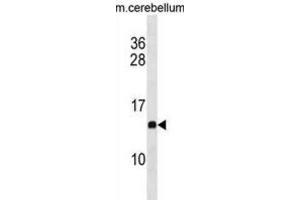 Western Blotting (WB) image for anti-Prefoldin Subunit 2 (PFDN2) antibody (ABIN3001026) (PFDN2 Antikörper)