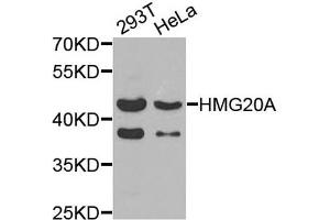 Western blot analysis of extracts of 293T and HeLa cells, using HMG20A antibody. (HMG20A Antikörper)
