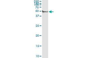 Immunoprecipitation of CYP3A4 transfected lysate using rabbit polyclonal anti-CYP3A4 and Protein A Magnetic Bead (CYP3A4 (Human) IP-WB Antibody Pair)