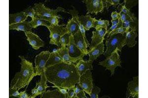 Immunofluorescence (IF) image for Goat anti-Mouse IgG antibody (Alexa Fluor 555) (ABIN2667000) (Ziege anti-Maus IgG Antikörper (Alexa Fluor 555))