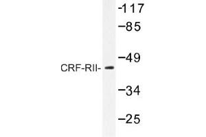 Image no. 1 for anti-Corticotropin Releasing Hormone Receptor 2 (CRHR2) antibody (ABIN317648) (CRHR2 Antikörper)