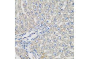 Immunohistochemistry of paraffin-embedded rat liver using METTL7A antibody (ABIN5974519) at dilution of 1/200 (40x lens). (METTL7A Antikörper)