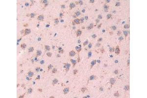 Used in DAB staining on fromalin fixed paraffin- embedded brain tissue (SYN2 Antikörper  (AA 88-422))