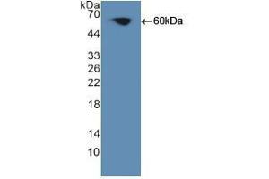 Western blot analysis of recombinant Human PKCq. (PKC theta Antikörper  (AA 380-634))