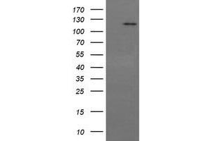 Image no. 6 for anti-PTK2 Protein tyrosine Kinase 2 (PTK2) antibody (ABIN1498193) (FAK Antikörper)