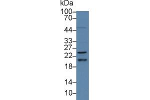 Western Blot; Sample: Human HepG2 cell lysate; Primary Ab: 5µg/ml Rabbit Anti-Human HRAS Antibody Second Ab: 0. (HRAS Antikörper  (AA 82-176))