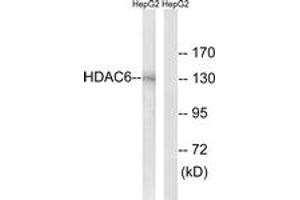Western blot analysis of extracts from HepG2 cells, using HDAC6 (Ab-22) Antibody. (HDAC6 Antikörper  (AA 7-56))
