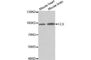 Western blot analysis of extracts of various cell lines, using FES antibody. (FES Antikörper  (AA 120-420))