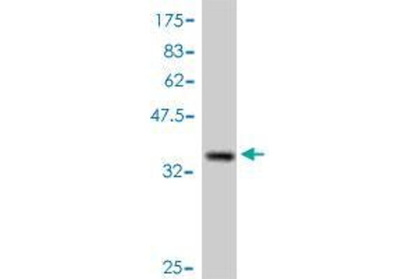 CTNNBIP1 Antikörper  (AA 1-81)