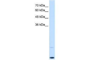WB Suggested Anti-MYC Antibody Titration:  0. (c-MYC Antikörper  (C-Term))