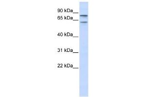 KCNQ1 antibody used at 1 ug/ml to detect target protein. (KCNQ1 Antikörper  (N-Term))
