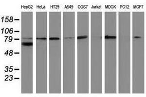 Image no. 2 for anti-Catenin (Cadherin-Associated Protein), beta 1, 88kDa (CTNNB1) antibody (ABIN1496896) (CTNNB1 Antikörper)