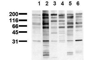 Western Blotting (WB) image for anti-Phosphotyrosine (phosphorylated) antibody (ABIN126878) (Phosphotyrosine Antikörper  (phosphorylated))