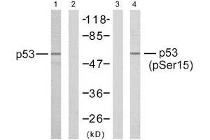 Western blot analysis of the extracts from HeLa cells untreated or treated with hydroxyurea using p53 (Ab-15) antibody (E021085, Line1 and 2) and p53 (phospho-Ser15) antibody (E011094, Line3 and 4). (p53 Antikörper)