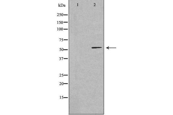 CCDC102A Antikörper  (Internal Region)