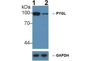 Knockout Varification: ;Lane 1: Wild-type Hepg2 cell lysate; ;Lane 2: PYGL knockout Hepg2 cell lysate; ;Predicted MW: 97kDa ;Observed MW: 100kDa;Primary Ab: 1µg/ml Rabbit Anti-Rat PYGL Ab;Second Ab: 0. (PYGL Antikörper  (AA 341-509))
