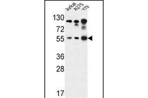 AKT1- antibody j western blot analysis in Jurkat,,Y79 cell line lysates (35 μg/lane). (AKT1 Antikörper  (AA 107-135))