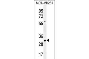 TNFAIP8L3 Antibody (Center) (ABIN655767 and ABIN2845207) western blot analysis in MDA-M cell line lysates (35 μg/lane). (TNFAIP8L3 Antikörper  (AA 136-164))