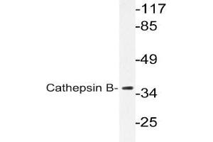 Western blot (WB) analysis of Cathepsin B Antibody in extracts from COLO cells. (Cathepsin B Antikörper)