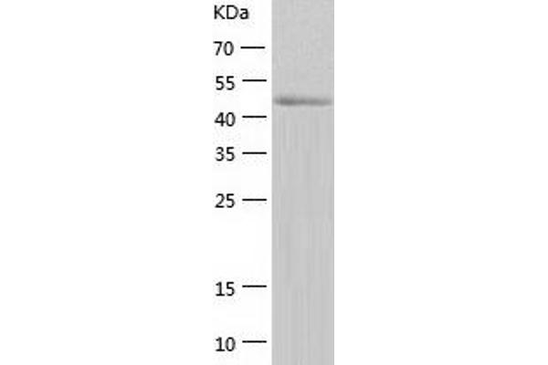 CAMK4 Protein (AA 1-473) (His tag)