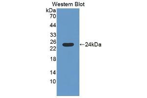 Western blot analysis of the recombinant protein. (SAT1 Antikörper  (AA 1-171))