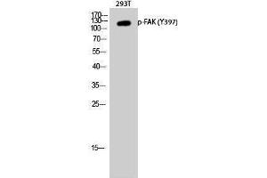 Western Blotting (WB) image for anti-PTK2 Protein tyrosine Kinase 2 (PTK2) (pTyr397) antibody (ABIN3179687) (FAK Antikörper  (pTyr397))