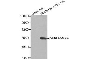 Western Blotting (WB) image for anti-Hepatocyte Nuclear Factor 4, alpha (HNF4A) (pSer304) antibody (ABIN1870237) (HNF4A Antikörper  (pSer304))