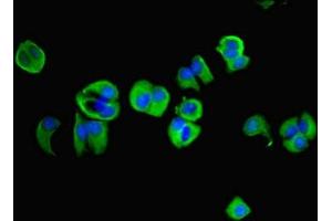 Immunofluorescent analysis of MCF-7 cells using ABIN7143935 at dilution of 1:100 and Alexa Fluor 488-congugated AffiniPure Goat Anti-Rabbit IgG(H+L) (NAPA Antikörper  (AA 1-295))