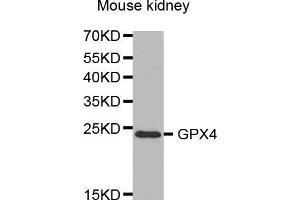 Western Blotting (WB) image for anti-Glutathione Peroxidase 4 (GPX4) (AA 30-197) antibody (ABIN6219078) (GPX4 Antikörper  (AA 30-197))