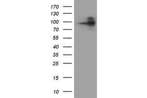 HEK293T cells were transfected with the pCMV6-ENTRY control (Left lane) or pCMV6-ENTRY FOLH1 (Right lane) cDNA for 48 hrs and lysed. (PSMA Antikörper)