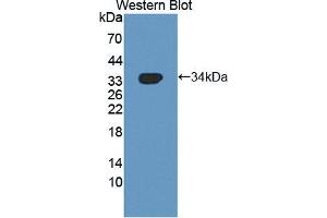 Western blot analysis of the recombinant protein. (NUAK1 Antikörper  (AA 421-658))