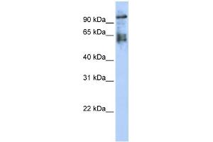 WB Suggested Anti-ZNF43 Antibody Titration:  0. (ZNF43 Antikörper  (Middle Region))