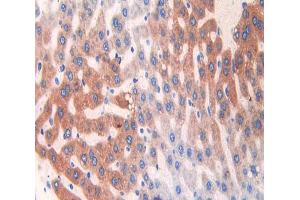 IHC-P analysis of liver tissue, with DAB staining. (CYP2E1 Antikörper  (AA 126-309))