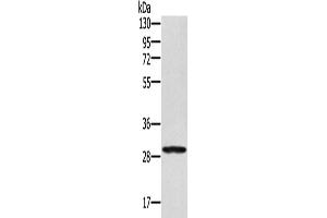 Western Blotting (WB) image for anti-Ectodysplasin A2 Receptor (EDA2R) antibody (ABIN2429982) (Ectodysplasin A2 Receptor Antikörper)