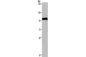 Western Blotting (WB) image for anti-Plasminogen (PLG) antibody (ABIN2435219) (PLG Antikörper)