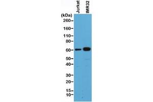 Western blot of human Jurkat and IMR32 cell lysate using recombinant SMAD4 antibody at 1:500. (Rekombinanter SMAD4 Antikörper  (C-Term))