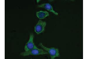 Human pancreatic carcinoma cell line MIA PaCa-2 was stained with Mouse Anti-Cytokeratin 19-FITC followed by DAPI. (Cytokeratin 19 Antikörper  (C-Term) (FITC))